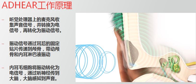 爱笛骨导助听器详细介绍和购买咨询！
