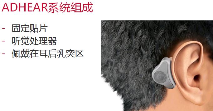爱笛骨导助听器详细介绍和购买咨询！