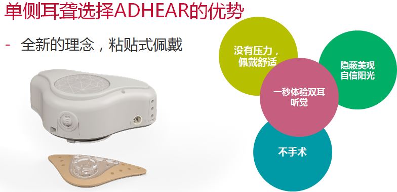 爱笛骨导助听器详细介绍和购买咨询！