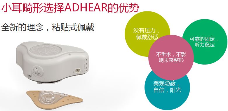 爱笛骨导助听器详细介绍和购买咨询！