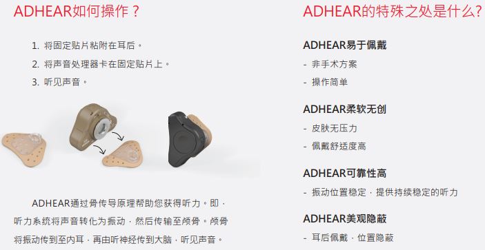 爱笛骨导助听器详细介绍和购买咨询！