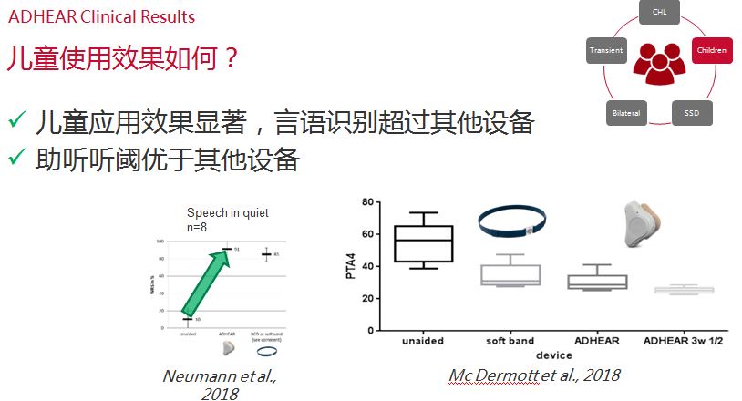 爱笛骨导助听器常见问答、使用效果与操作经验！