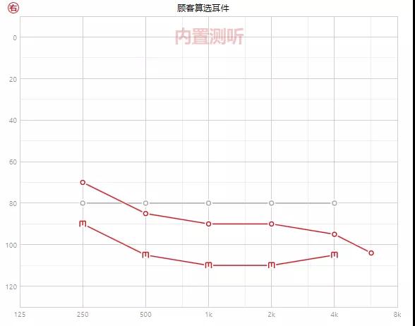 自在聆听，何需隐藏丨我与峰力黑曜石的美好聆听之旅
