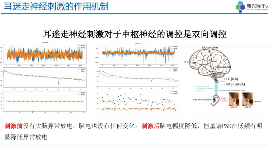 睡眠仪官方介绍图片